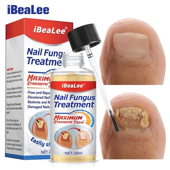 iBeaLee o Fungo do Prego do Tratamento de 7 dias de Reparação de Essência de Soro Mão Cuidados com as Unhas do Pé Fúngicas de Remoção de Creme Anti-infecciosa Onicomicose